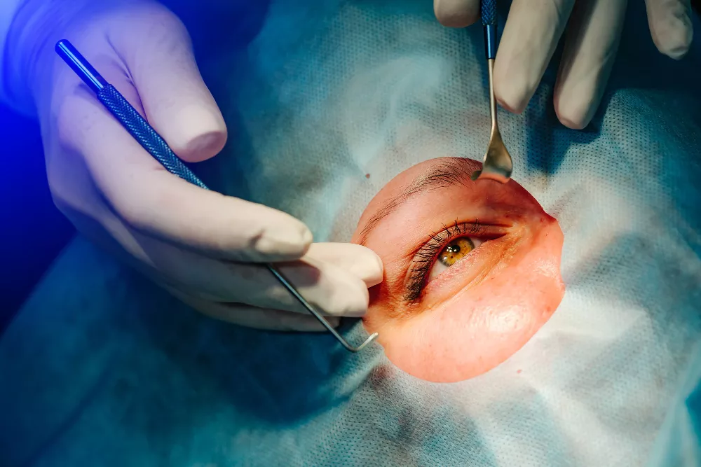 Viterio Retinal Surgeries